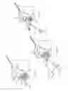 Fig. 11 - Combination reamer/drill bit for shoulder arthoplasty