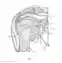 Fig. 02 - Combination driver/anti-rotation handle for shoulder arthroplasty