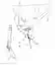 Fig. 10 - Combination driver/anti-rotation handle for shoulder arthroplasty