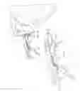 Fig. 11 - Combination driver/anti-rotation handle for shoulder arthroplasty