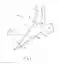 Fig. 02 - Patient-specific instruments for total ankle arthroplasty