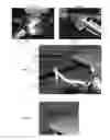 Fig. 04 - Computer controlled laser therapy treatment table