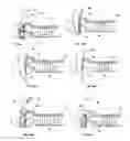 Fig. 14 - Methods of meniscus repair