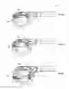 Fig. 18 - Methods of meniscus repair