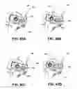 Fig. 24 - Methods of meniscus repair
