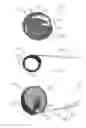 Fig. 06 - Devices and methods for the treatment of vascular defects