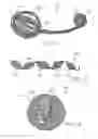 Fig. 10 - Devices and methods for the treatment of vascular defects
