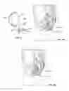 Fig. 03 - RECTAL STIMULATION DEVICE