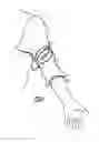 Fig. 02 - QUICK RELEASE TOURNIQUET
