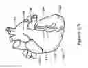 Fig. 02 - INTRACARDIAC CAGE AND METHOD OF DELIVERING SAME