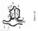 Fig. 28 - INTRACARDIAC CAGE AND METHOD OF DELIVERING SAME