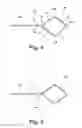 Fig. 04 - Removable localizing wire