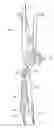 Fig. 01 - Instruments and methods for adjusting separation distance of vertebral bodies with a minimally invasive spinal stabilization procedure