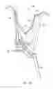 Fig. 14 - Instruments and methods for adjusting separation distance of vertebral bodies with a minimally invasive spinal stabilization procedure