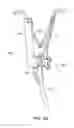 Fig. 17 - Instruments and methods for adjusting separation distance of vertebral bodies with a minimally invasive spinal stabilization procedure