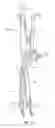 Fig. 20 - Instruments and methods for adjusting separation distance of vertebral bodies with a minimally invasive spinal stabilization procedure
