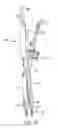 Fig. 24 - Instruments and methods for adjusting separation distance of vertebral bodies with a minimally invasive spinal stabilization procedure