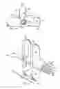 Fig. 09 - Spondylolisthesis correction apparatus and method