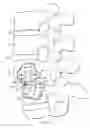 Fig. 16 - Spondylolisthesis correction apparatus and method