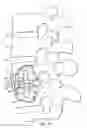 Fig. 18 - Spondylolisthesis correction apparatus and method