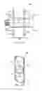 Fig. 22 - Spondylolisthesis correction apparatus and method