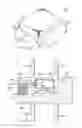 Fig. 25 - Spondylolisthesis correction apparatus and method