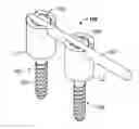 Fig. 01 - System and method for spine stabilization using resilient inserts