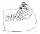 Fig. 01 - Instrument and method for spinal compression and distraction