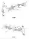 Fig. 09 - Instrument and method for spinal compression and distraction