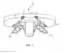 Fig. 02 - System and method for bone anchor removal