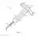 Fig. 04 - System and method for bone anchor removal