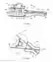 Fig. 05 - System and method for bone anchor removal