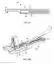 Fig. 08 - System and method for bone anchor removal