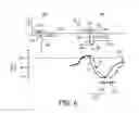 Fig. 06 - Atrial nerve stimulation with ventricular pacing