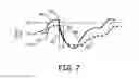 Fig. 07 - Atrial nerve stimulation with ventricular pacing