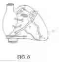 Fig. 07 - Individually adapted cardiac electro-mechanical synchronization therapy