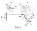 Fig. 06 - Atrial nerve stimulation with ventricular pacing