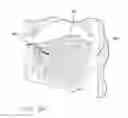 Fig. 09 - Apparatus and method for treating obstructive sleep apnea
