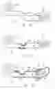 Fig. 09 - Visual prosthesis including a flexible circuit electrode array