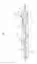 Fig. 02 - Twisting bifurcation delivery system