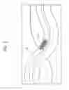 Fig. 03 - Twisting bifurcation delivery system