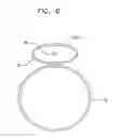 Fig. 07 - Twisting bifurcation delivery system