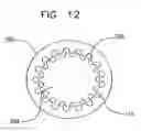 Fig. 13 - Twisting bifurcation delivery system