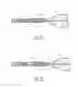 Fig. 02 - Stent delivery system with nitinol trigger wire