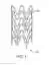 Fig. 02 - Stents including poly(L-lactide) formulations that minimize molecular weight drop during processing
