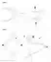Fig. 17 - FLEXIBLE INTRALUMINAL STENT