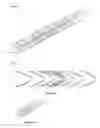 Fig. 27 - FLEXIBLE INTRALUMINAL STENT