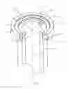 Fig. 02 - Vertebral implant