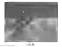 Fig. 04 - Method of using instruments and interbody spinal implants to enhance distraction