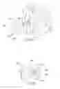 Fig. 17 - Method of using instruments and interbody spinal implants to enhance distraction